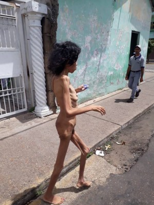 Mujer esquelética Cantaura , capital del municipio Pedro María Freites, Estado Anzoátegui , Venezuela.jpg