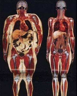 mujer con 113 kg y otra con 54 kg.jpg