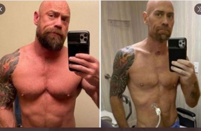 Mike Schultz enfermero contagiado covid san franciasco.JPG